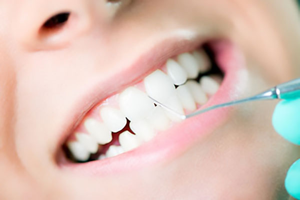 Reshaping Teeth Through Cosmetic Dentistry