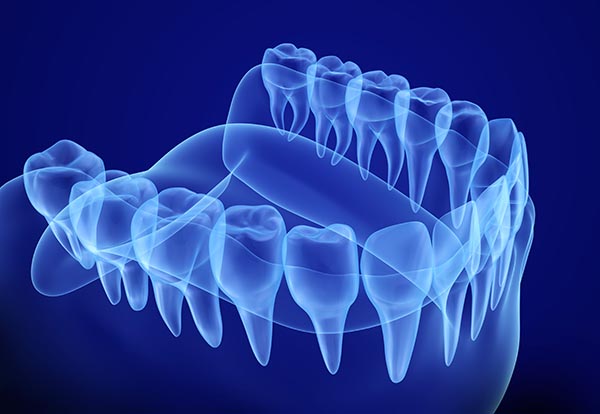 Austin Endodontist