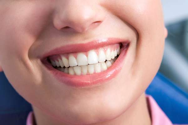 A General Dentist Discusses the Benefits of Tooth Straightening from Austin Lakes Dentistry: Scott T Gordon DDS in Austin, TX