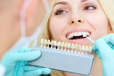 Dental Veneer