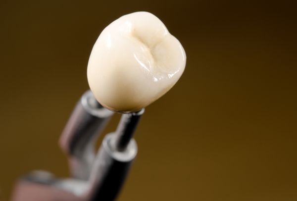 Dental Crowns Austin, TX