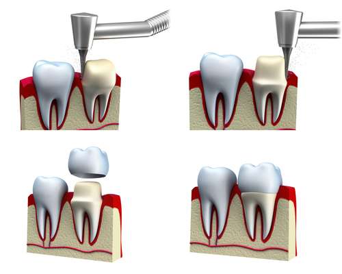 CEREC Dentist