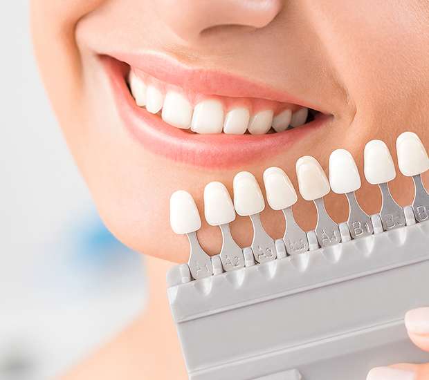 Austin Veneers
