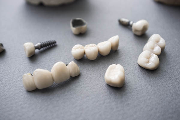 Everything You Need To Know About A Dental Implant Restoration