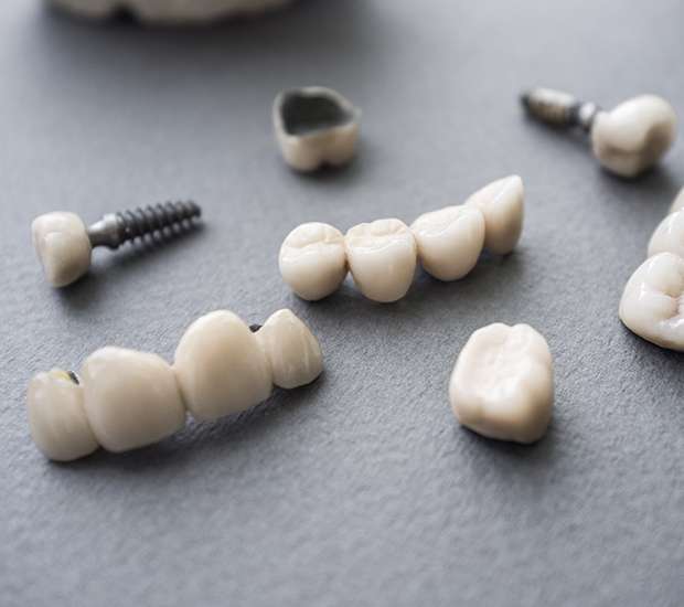 Austin The Difference Between Dental Implants and Mini Dental Implants