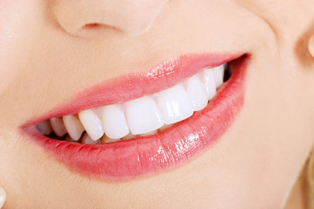 Austin Teeth Whitening Can Impact Your Smile And More!